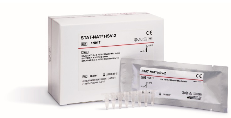STAT-NAT® HSV-2